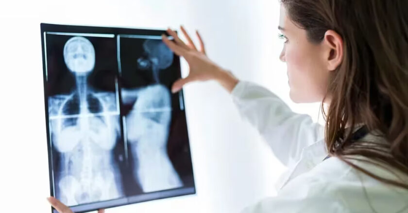 Tratamientos personalizados contra el cáncer de mama, un avance hacia terapias menos agresivas