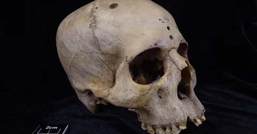 Descubren pistas de un tratamiento experimental contra el cáncer hecho hace 4.000 años en el Antiguo Egipto