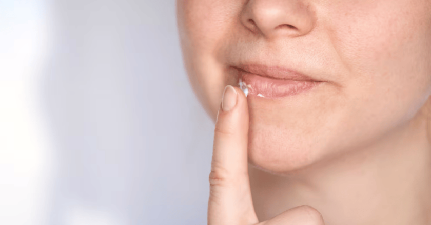 Por qué se secan los labios y el problema de salud que expresan de la persona que los tiene