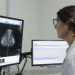 La PBA comenzará a indicar la mamografía a los 40 años