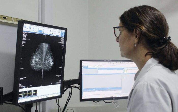La PBA comenzará a indicar la mamografía a los 40 años